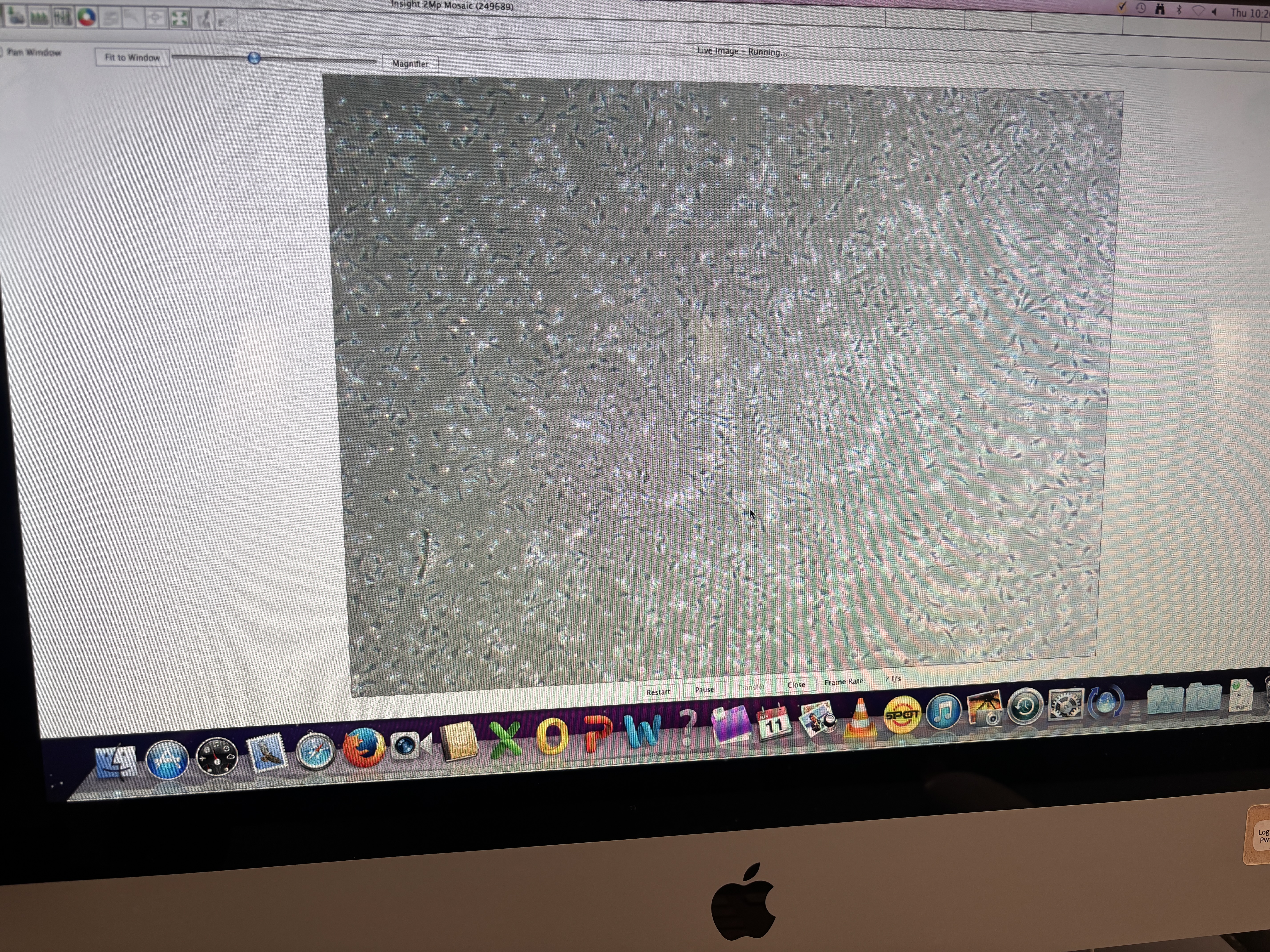 fibroblasts