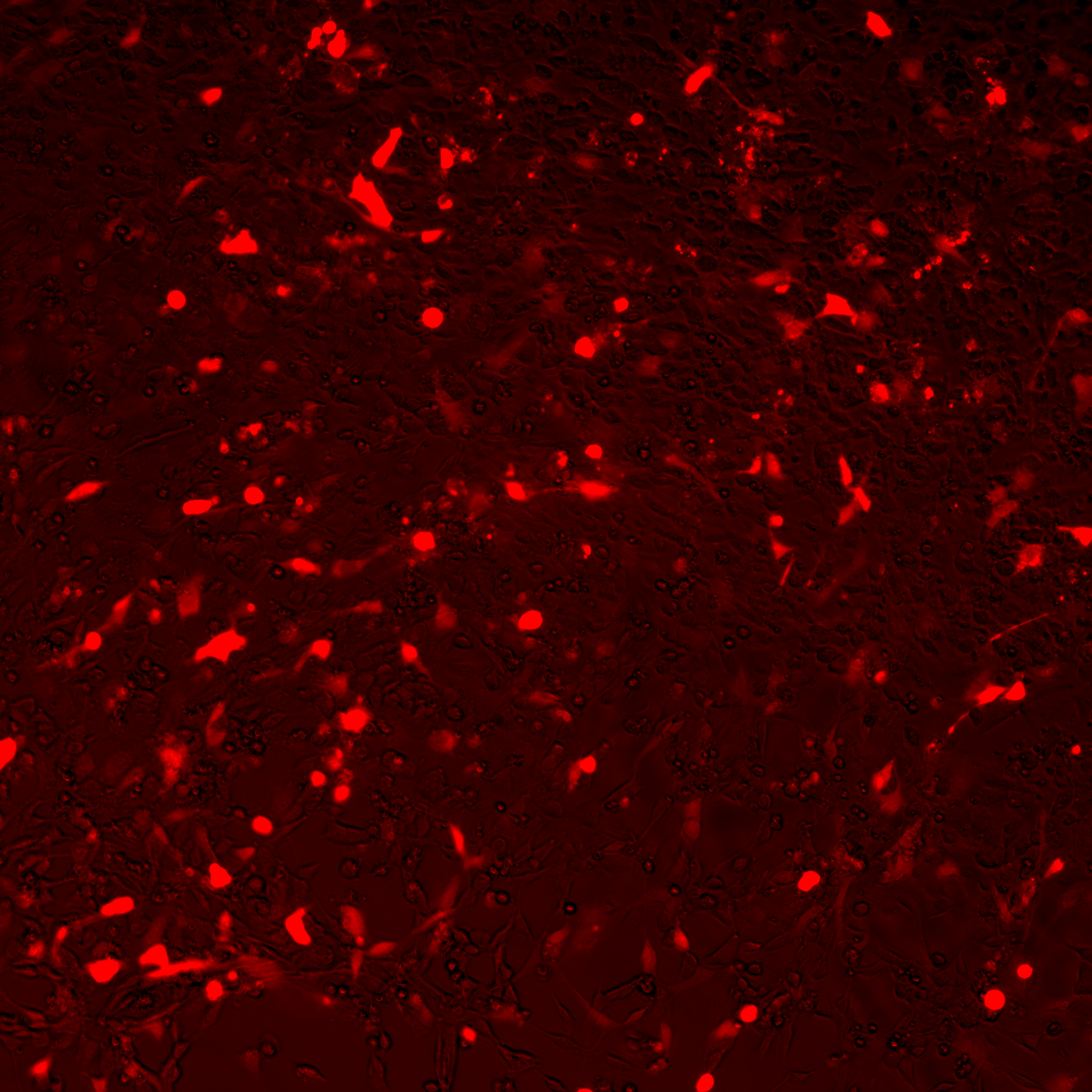 fibroblasts 2