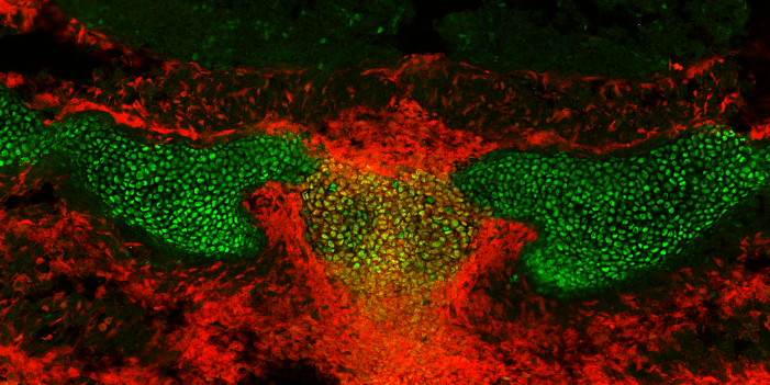 Immunofluorescence